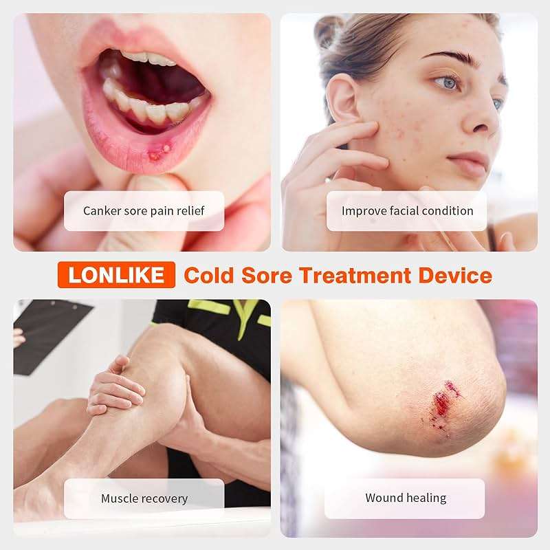 Red Light Cold Sore, Cold Sore Treatment Device, Red Light Therapy Wand for Cold Sore Lips Nose Face Hand, Target Skin Small Area - Image 3
