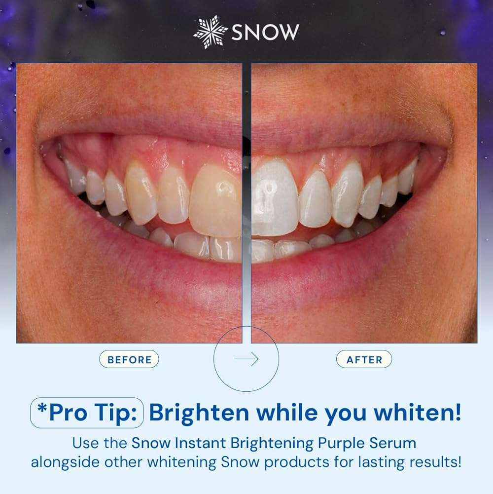 SNOW Teeth Brightening Purple Serum | Gentle & Enamel Safe Instant Brightening for Brighter Smile | Dental Care, Hygiene, & Tooth Care Bright Smile for Events Daily Confidence 2 Month Supply - Image 6