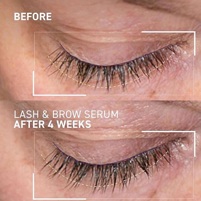 Dr. Brandt Dr. B Lab Lash & Brow Serum - Growth & Conditioning Formula for Longer, Fuller Hair Follicles - 0.17 fl oz - Image 2