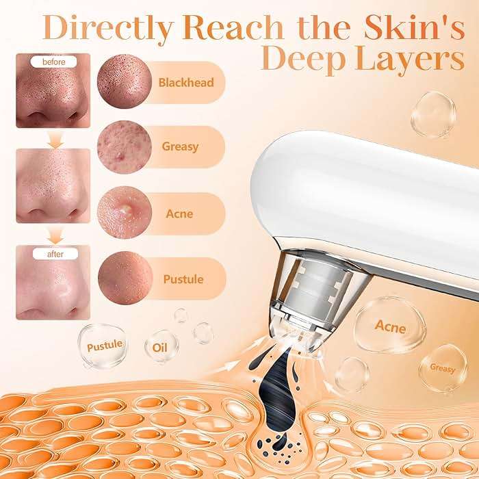 Yccu Blackhead Remover Vacuum Pore Extractor Black Head Remover for Face Blackhead Extractor Pore Vacuum Pimple Extractor Skin Tag Remover Tool Pore Cleaner with USB Charge 4 Modes 5 Suction Heads - Image 3