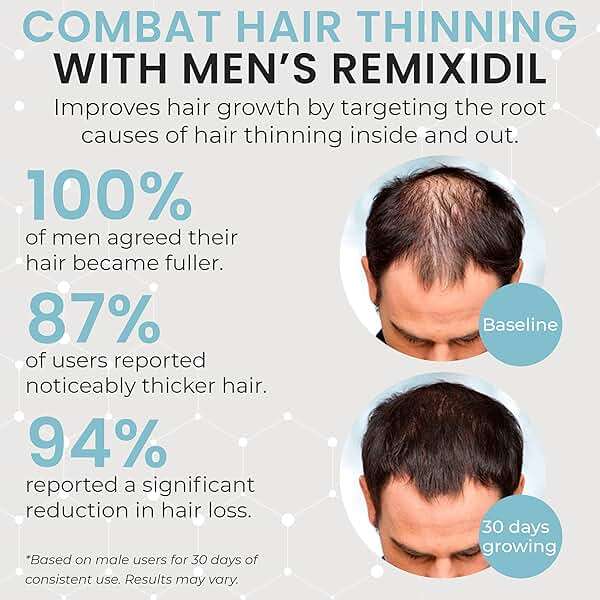 Hair Growth Vitamins Hair Regrowth For Men | Supports Beard And Scalp Strength | Helps Reduce Thinning And Breakage | Fast-Acting Formula To Boost Volume | 60 Capsules - Image 2