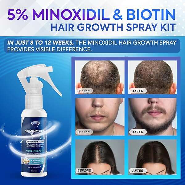 5% Minoxidil Hair Growth for Men and Women: Extra Strength Minoxidil and Biotin Beard Regrowth (2 Fl Oz, Spray 3pcs) - Image 2