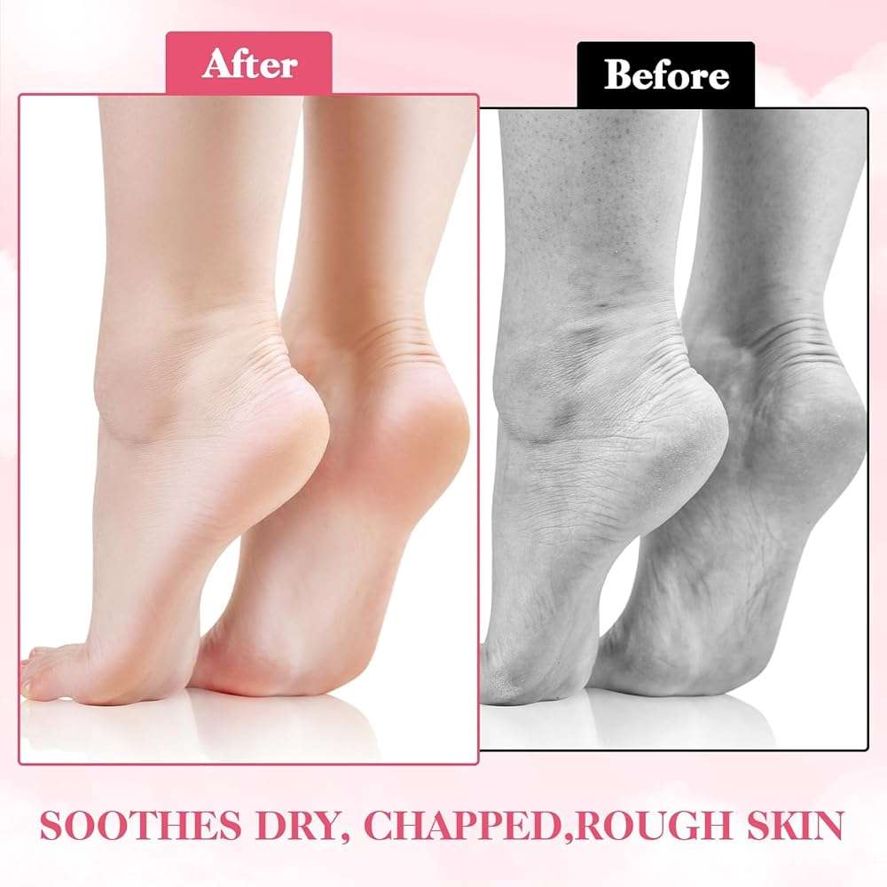 3 Pairs Moisturizing Socks Overnight, Spa Socks for Dry Feet, Cotton Moisture Enhancing Sock, Lotion Sock for Cracked Heel Repair, Cosmetic Moisturizing Sockss for Women White - Image 4
