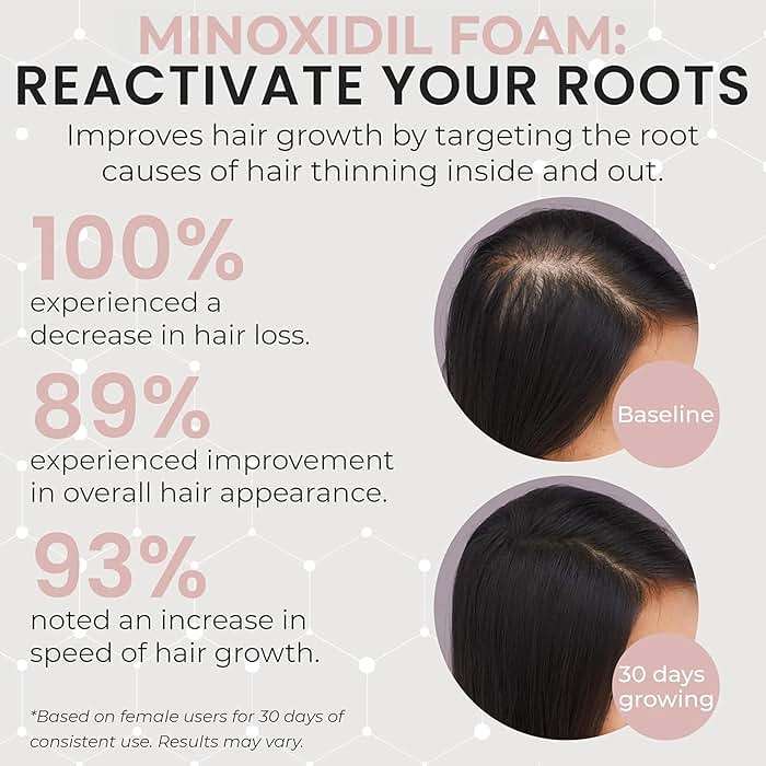 Minoxidil for Women | 5% Minoxidil For Women Hair Growth | Hair Regrowth Treatment | Unscented Topical Foam | Dermatologist Recommended | Clinically Proven Formula | 3 Month Supply - Image 2