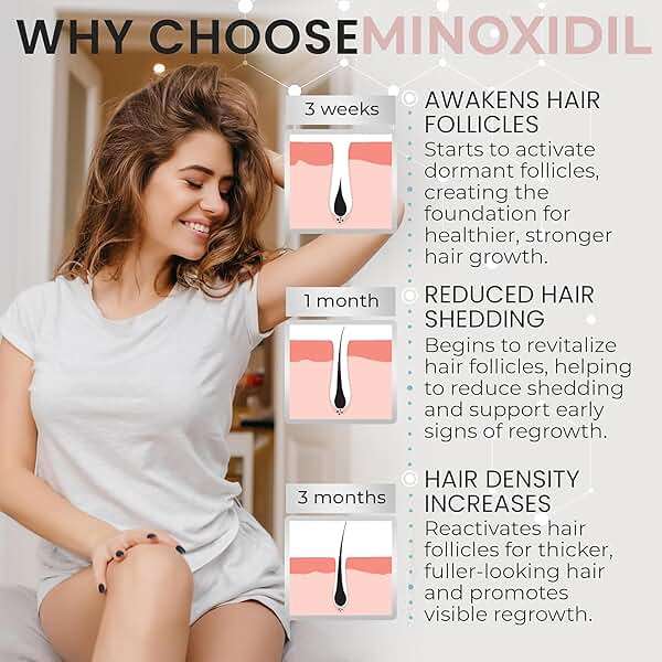 Minoxidil for Women | 5% Minoxidil For Women Hair Growth | Hair Regrowth Treatment | Unscented Topical Foam | Dermatologist Recommended | Clinically Proven Formula | 3 Month Supply - Image 3