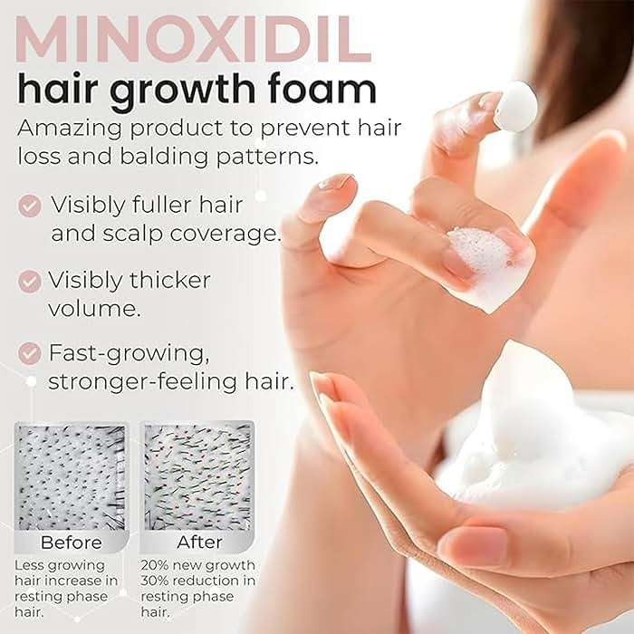 Minoxidil for Women | 5% Minoxidil For Women Hair Growth | Hair Regrowth Treatment | Unscented Topical Foam | Dermatologist Recommended | Clinically Proven Formula | 3 Month Supply - Image 4