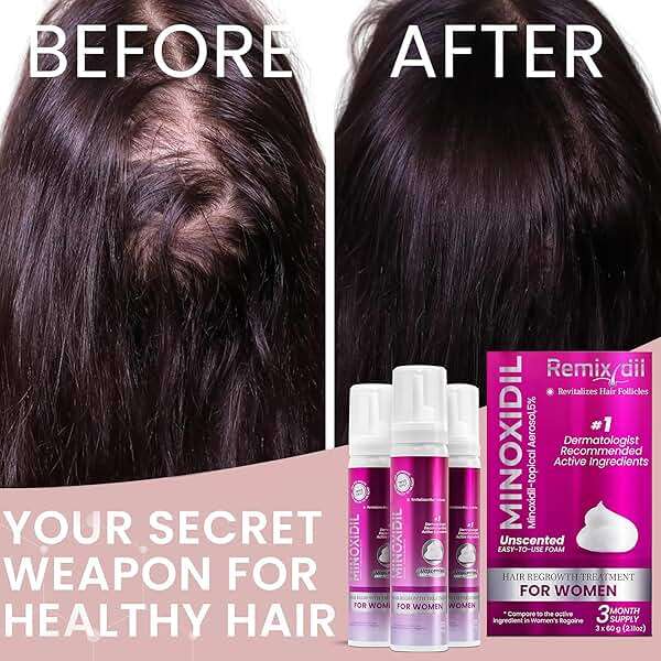Minoxidil for Women | 5% Minoxidil For Women Hair Growth | Hair Regrowth Treatment | Unscented Topical Foam | Dermatologist Recommended | Clinically Proven Formula | 3 Month Supply - Image 6