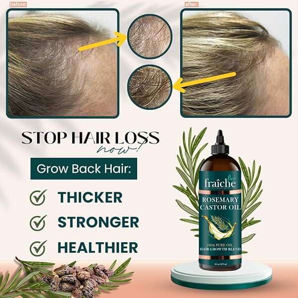 Live Fraiche Rosemary Castor Oil for Hair Growth 16oz - Rosemary Oil for Hair Growth and Thickening Pure Blend to Reduce Loss and Promote a Healthy Scalp - Image 2