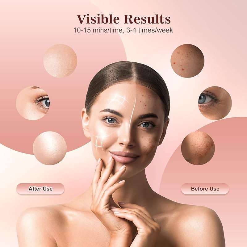 INTEO Red Light Therapy for Face, 3 Modes Portable Red Light Therapy Mask (NIR 850nm&Red 620nm, Yellow, Blue) with Timing Function, 2000mAh Rechargeable Red Light Mask Skin Care for Home Travel Yoga - Image 4
