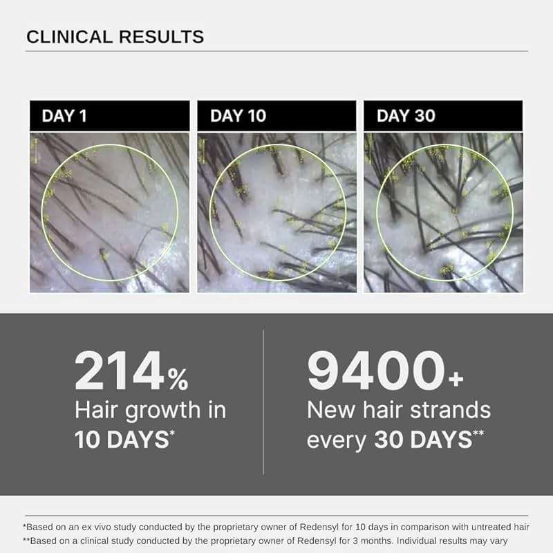 Bare Anatomy Advanced Hair Growth Serum| 3% Redensyl - 2x Better Results than Minoxidil | + 4% Anagain + 3% Baicapil | Rosemary, Biotin | Hair growth & Hair fall control serum for Women & Men | 30mL - Image 5