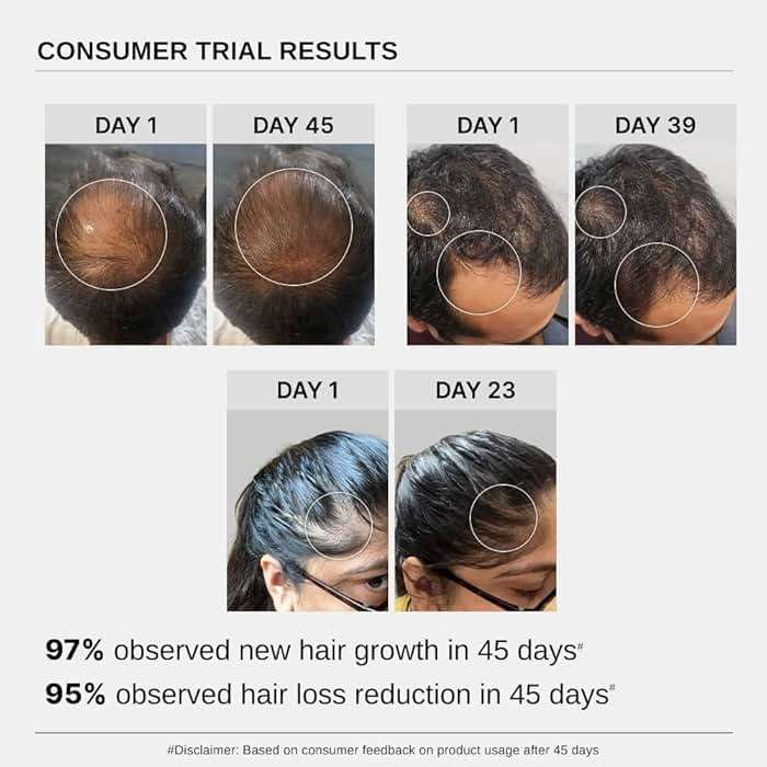 Bare Anatomy Advanced Hair Growth Serum| 3% Redensyl - 2x Better Results than Minoxidil | + 4% Anagain + 3% Baicapil | Rosemary, Biotin | Hair growth & Hair fall control serum for Women & Men | 30mL - Image 6