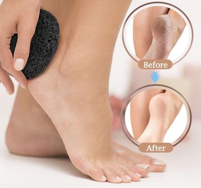 RDRKR Natural Lava Pumice Stone for Feet & Hands – Callus & Corn Remover for Cracked Heels, Hard Dry Skin Exfoliator, Volcanic Foot Scrubber Pedicure Tool (Black) - Image 6