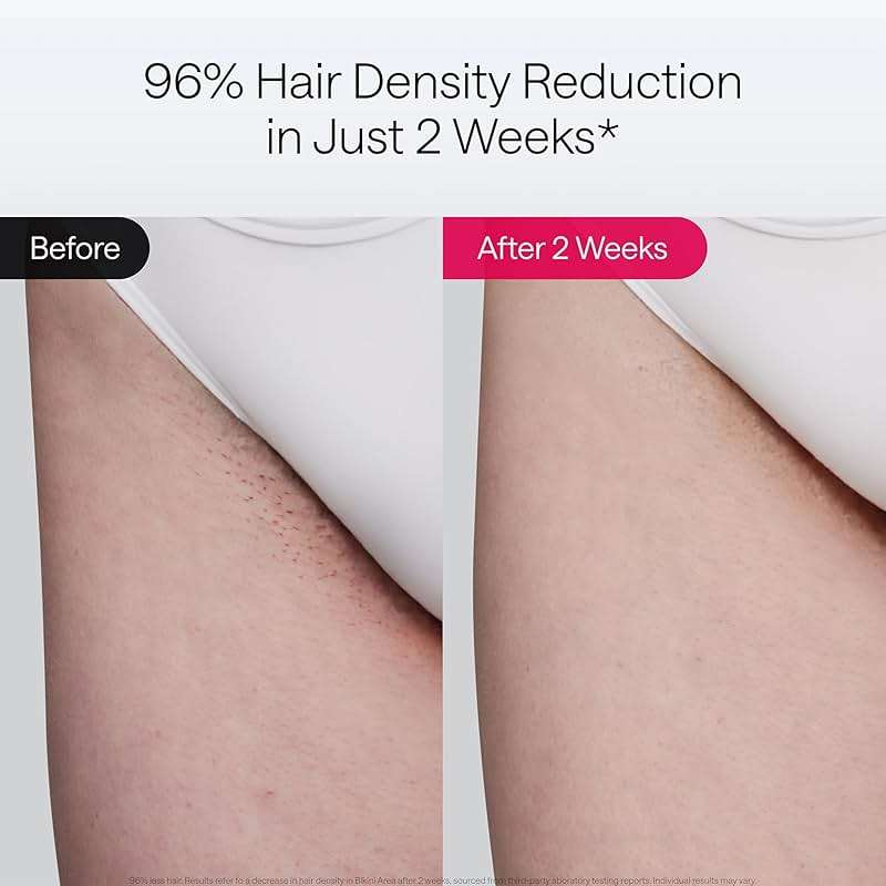Ulike Laser Hair Removal Device Air 10 Ipl Gift for Women and Men, Ice cool and Permanent hair Reduction for Nearly Painless, Dual Lights, Skin Sensor & USHR Mode Hair Removal in 10mins from Home - Image 4