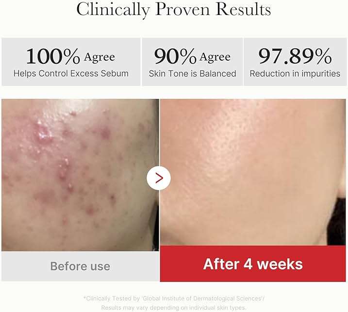 medicube Toner Pads Red Succinic Acid Panthenol Facial Peeling Pad | Exfoliating Toner Pad for Breakout-Prone Skin | Niacinamide, AHA, BHA, and Soothing Panthenol - Non-Comedogenic, 70 Pads (1 Pack) - Image 4