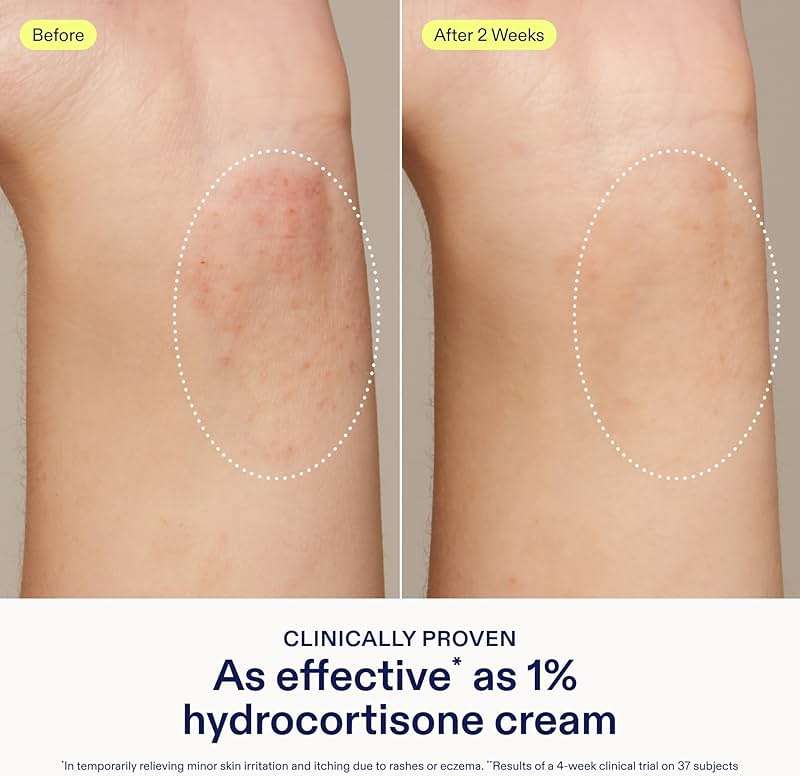 Skinfix Dermatitis Relief Balm with 5% Colloidal Oatmeal & Vitamin E - 1.7 fl oz - Proven Effective as 1% Hydrocortisone - Relieves Eczema & Itch - Accepted by the National Eczema Association - Image 3