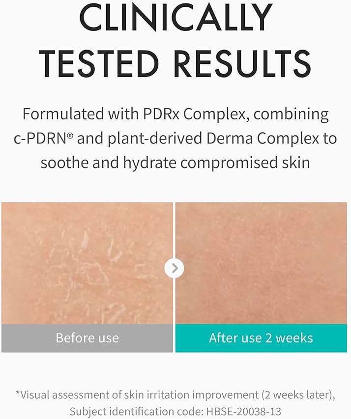 REJURAN® Moisture Cream, c-PDRN® - Daily Moisturizer for Long-Lasting Hydration and Skin Barrier Support with PDRx. (2.11 oz) - Image 3