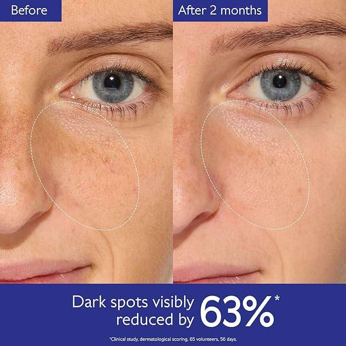 Caudalie Vinoperfect Brightening Dark Spot Serum Vitamin C Alternative - 62x More Effective than Vitamin C with Viniferine for a Visibly Brighter Even Complexion - Image 4