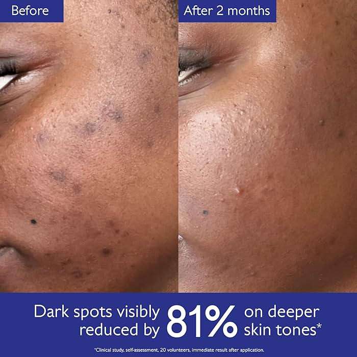 Caudalie Vinoperfect Brightening Dark Spot Serum Vitamin C Alternative - 62x More Effective than Vitamin C with Viniferine for a Visibly Brighter Even Complexion - Image 5