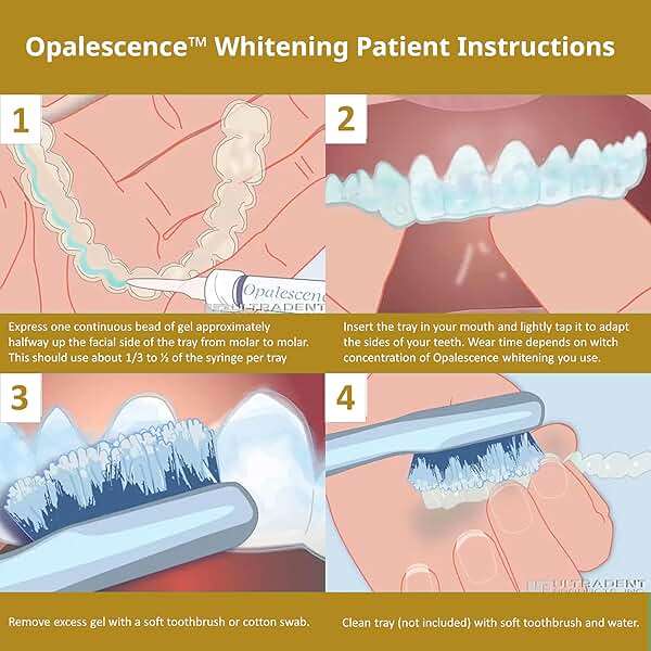 Opalescence 45% Syringes Teeth Whitening Gel - with PF - (8 Syringes) Refill Kit Carbamide Peroxide. Made by Ultradent, in Mint Flavor. Tooth Whitening 5359-4 - Image 6