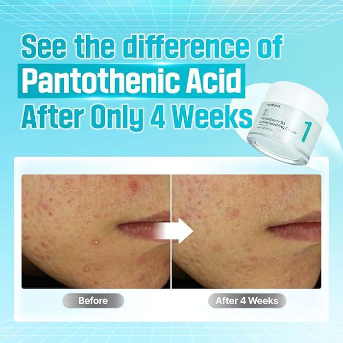 numbuzin No.1 Pantothenic B5 Active Soothing Cream | Remove sebum and skin troubles, Pantothenic acid, Korean Skincare Gift for Women | 2.70 fl oz - Image 4
