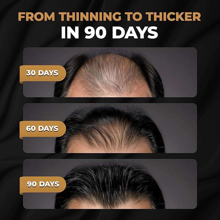 SPARTAN™ Root Activator Shampoo For Men - Hair Growth Shampoo for Hair Loss and Thinning Hair - Image 2