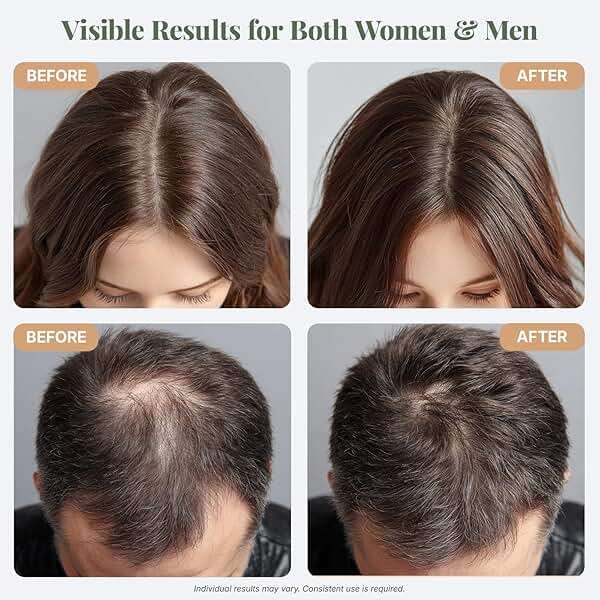 The ÉLIX USDA Organic Rosemary Oil for Hair Growth | Thickening Formula with Castor & Pumpkin Seed | for Hair Loss & Thinning | Made in USA | 4oz - Image 5