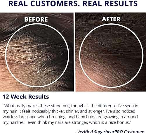 SugarbearPRO Hair Vitamin Gummy 1 Month Supply, Extra Strength Biotin 6000mcg for Hair Growth, Vegan Vitamin B12, MSM, Inositol, Omega 3, Elderberry, Certified Kosher, Halal, Cruelty-Free - Image 6