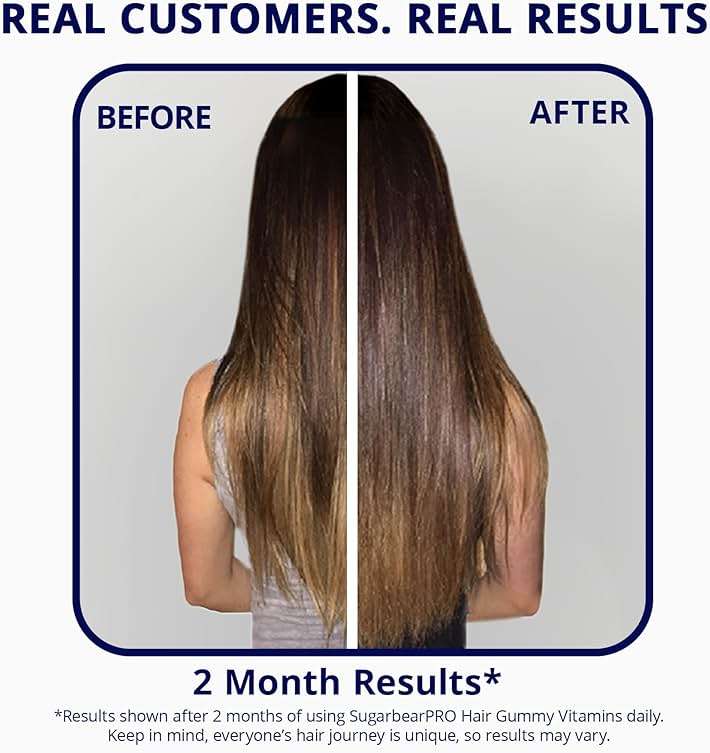 SugarbearPRO Hair Vitamin Gummy 1 Month Supply, Extra Strength Biotin 6000mcg for Hair Growth, Vegan Vitamin B12, MSM, Inositol, Omega 3, Elderberry, Certified Kosher, Halal, Cruelty-Free - Image 8
