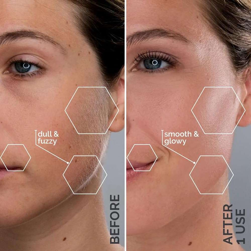 Michael Todd Beauty Sonicsmooth Pro+ Dermaplane Razor Blade Refills | 8 Dermaplaning Blades, 2 Month Supply, Device Not Included - Image 3