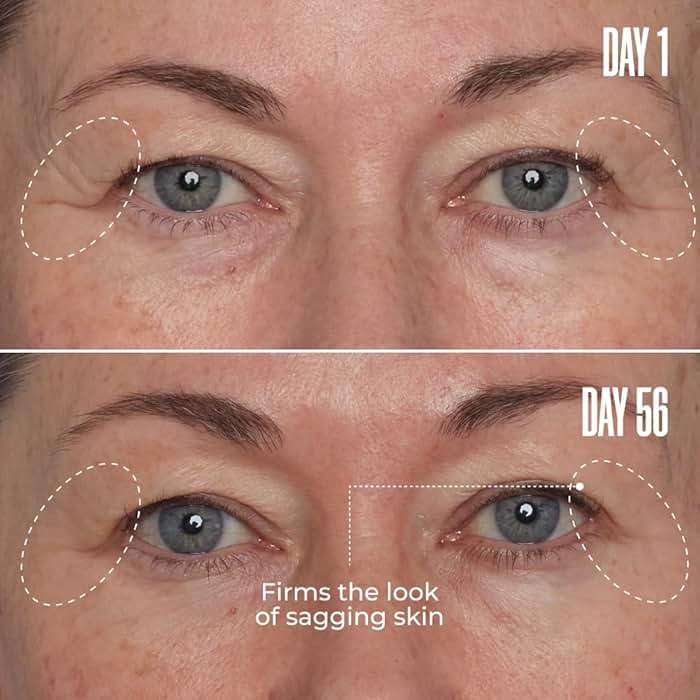 MAËLYS TOO-FINE Firming Anti-Aging Face Serum - Instantly Lifted Look - Glaucine & Bacillus Ferment - Face Tightening Serum Helps Lift Look of Sagging Skin on Jawline, Cheekbones & Under Eyes (15 mL) - Image 4