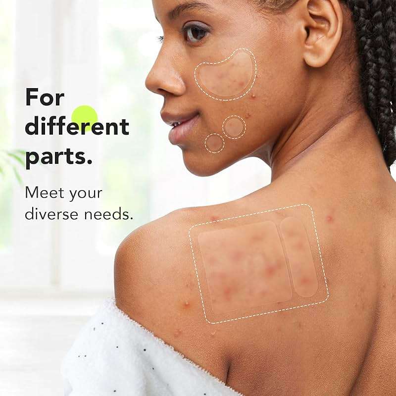 LitBear Large Pimple Patches (7 Sizes 112 Counts), Big Acne Patches, XL Hydrocolloid Bandages for Full Face, Forehead, Chin, Nose, Body, Back, Neck & Chest, Oval, Moon, Square hydrocolloid Patch - Image 3