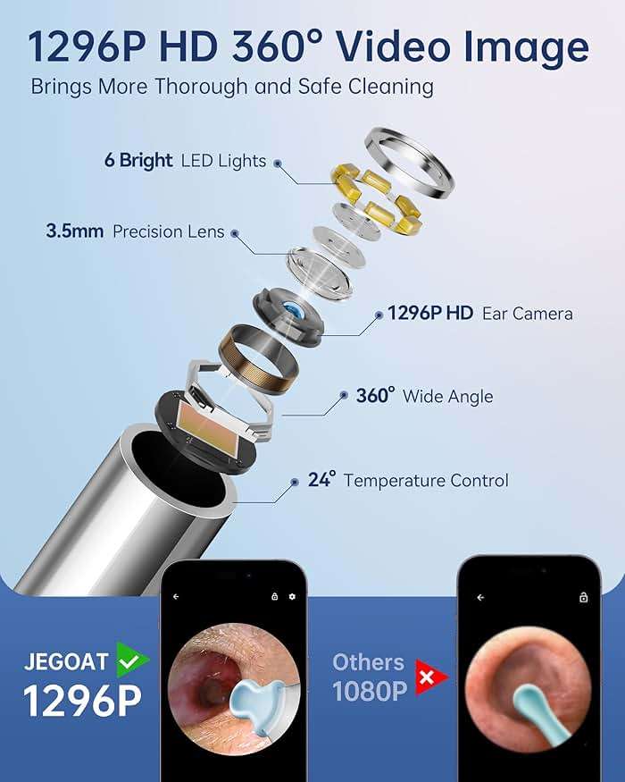 Ear Wax Removal Tool Camera, Ear Cleaner with Camera, 1296P HD Ear Scope, 6 LED Lights and 12 Ear Picks, Earwax Removal with Otoscope, Jet Black - Image 3