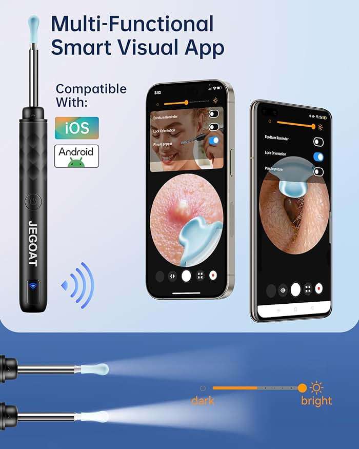 Ear Wax Removal Tool Camera, Ear Cleaner with Camera, 1296P HD Ear Scope, 6 LED Lights and 12 Ear Picks, Earwax Removal with Otoscope, Jet Black - Image 6
