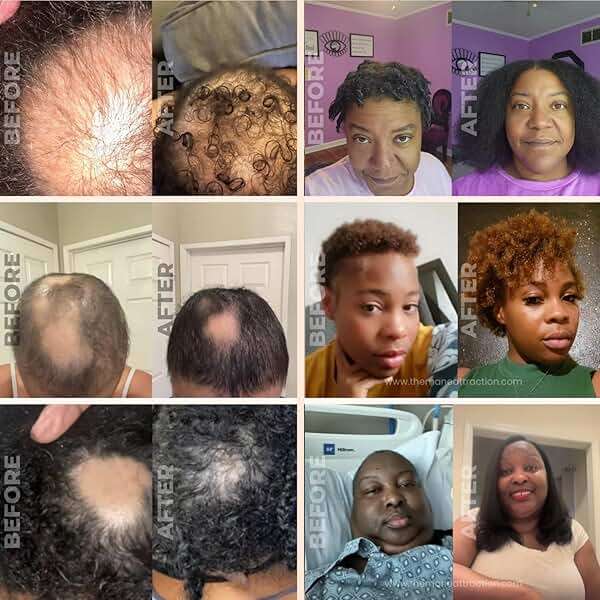 The Mane Attraction Hair Oil for All Hair Types, Infused with Rosemary Oil, Castor Oil & Black Seed Oil - Stimulating Hair Growth, Seals in Moisture, Soothes Irritated Scalp - 4 Fl Oz - Image 4