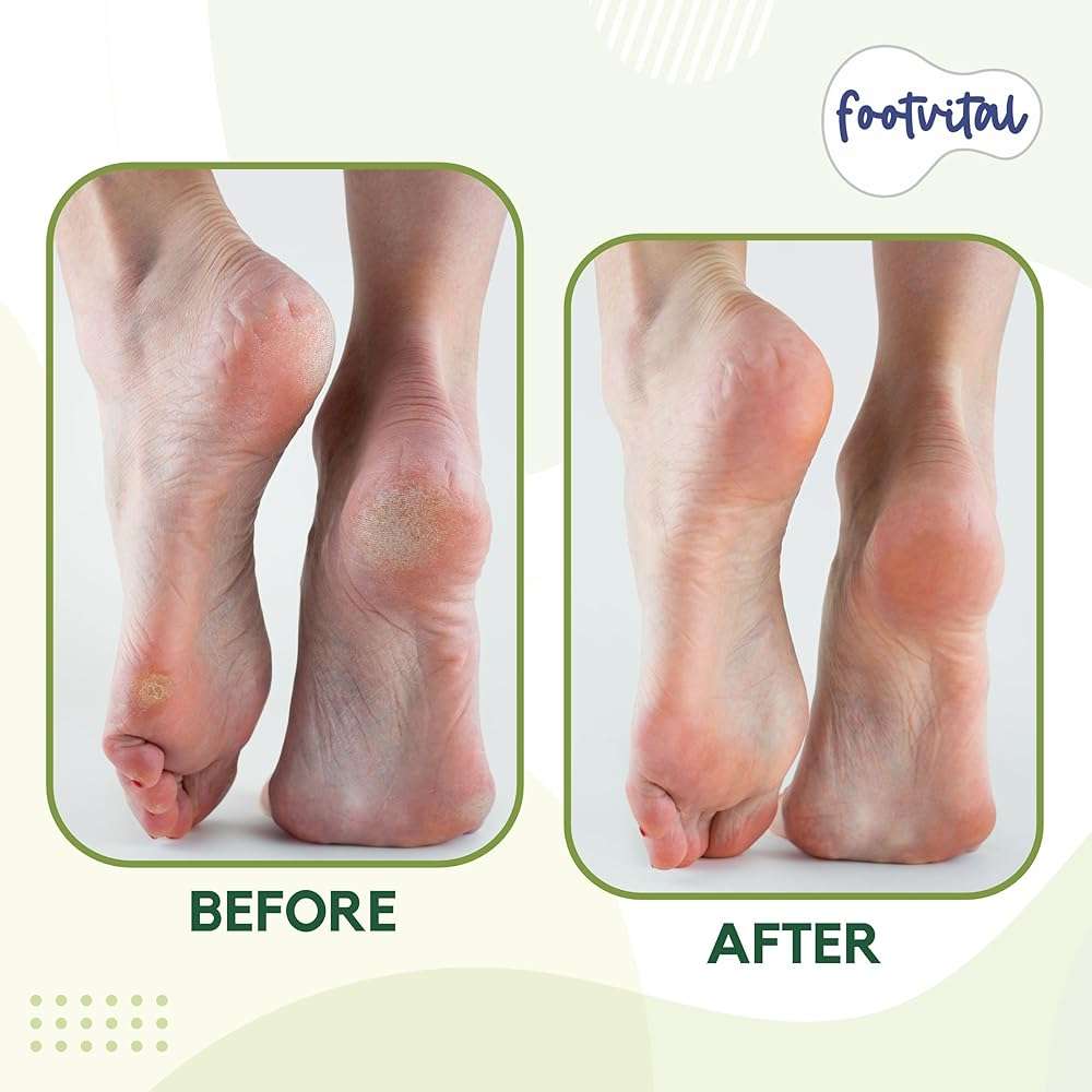 FootVital Pumice Stone for Feet Callus Remover - Terra-Cotta Foot Scrubber with 2 Sides, 100% Pure Natural Foot Pumice Stone, Pedicure Scrubber, Foot Exfoliator, Removes Calluses & Dead Skin - Image 5