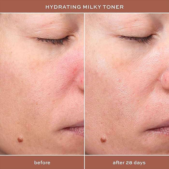 ITK Hydrating Hyaluronic Acid Milky Face Toner for Dry Skin + Redness with Green Tea + Squalane - Prep, Tone + Calm Skin for Women - Soothing Vegan Moisturizing Facial Toner - 5 oz. - Image 6