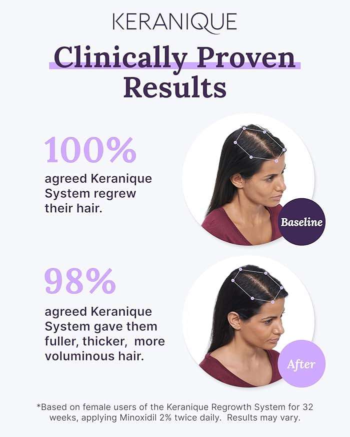 Keranique Women's 5% Topical Minoxidil Foam – Hair Regrowth Scalp Treatment with Powerful NutriGrow blend - Supports Thicker, Fuller, Healthier Hair & Scalp - 4 Month Supply - Image 4