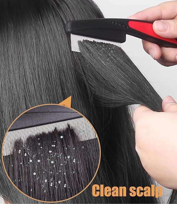 Self-Cleaning Dandruff Comb 2-Pack Set, Hollow Teeth Button-Release Scalp Detox, Fine Tooth 0.5mm & 2mm for Nits Buildup Removal, Women Men Kids, Stainless Steel Ergonomic Anti-Slip Hair Care Tool - Image 3