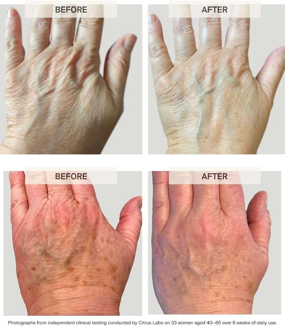 Habelo Activating Hand Serum | Smooths, Heals, Repairs, and Brightens | 1.5 oz./45 ml | Moisturizing Clean Hand Cream | Clinically Proven Safe and Effective - Image 6