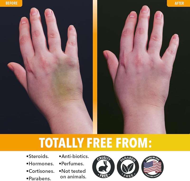Dr. Robaina Arnica Gel 4 oz – Concentrated Arnica montana with MSM, Magnesium & Vitamin E | Unscented Cooling Gel for Thin Skin | Fast-Absorbing, Non-Greasy | Made in USA - Image 4