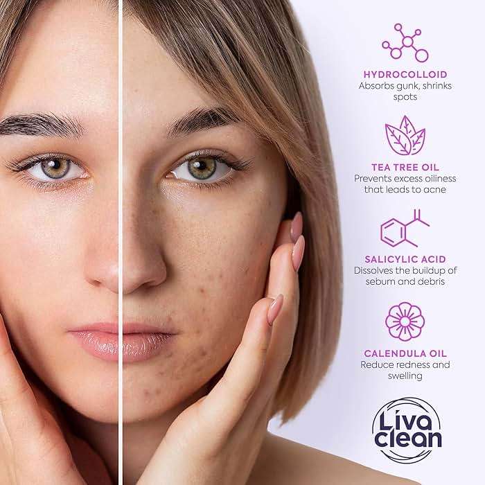 LivaClean 330 CT Pimple Patches for Face w/Salicylic Acid, Tea Tree Oil & Calendula Oil - Four Sizes - Pimple Patch, Hydrocolloid Patch, Acne Patches for Face - Image 6