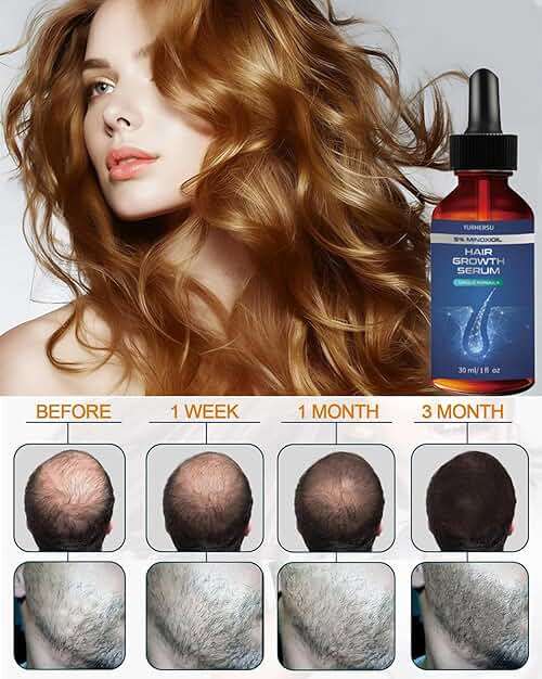 ELCHHIRSCH Hair Growth Serum, 5% Minoxidil, With Biotin & Glycerin, for Men's Beard & Women's Hair Regrowth, Anti Hair Loss Treatment, Make Hair Stronger Thicker Longer, 1 fl oz (30 ml), Blue - Image 3