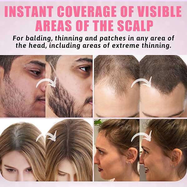 ZENTANMEI Root Touch Up Hairline Powder for Women & Men, Gray Hair Cover Up, Hairline Shadow Powder Sweatproof & Windproof, 0.14 oz Root Cover Up for Thinning Hair (Brown) - Image 4