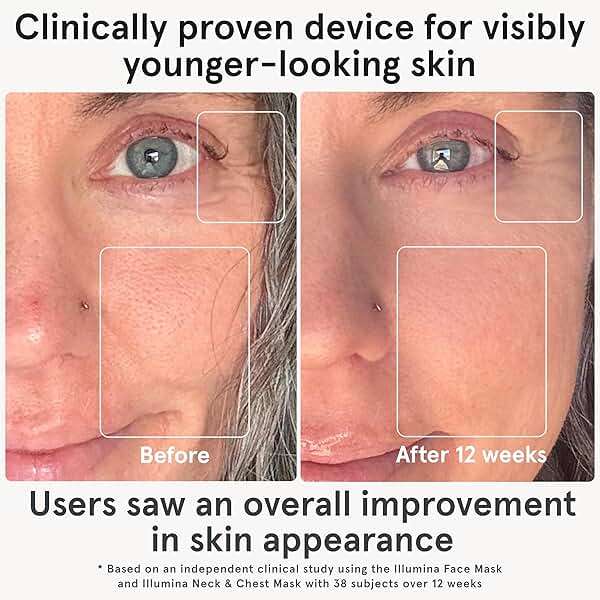 iRestore LED Face Mask for Youthful Skin, Red Light Therapy for Face, Red, Blue & Infrared Therapy for Wrinkles, Fine Lines, Dark Spots with 360 LEDs, Skincare Device for Women & Men - Image 2