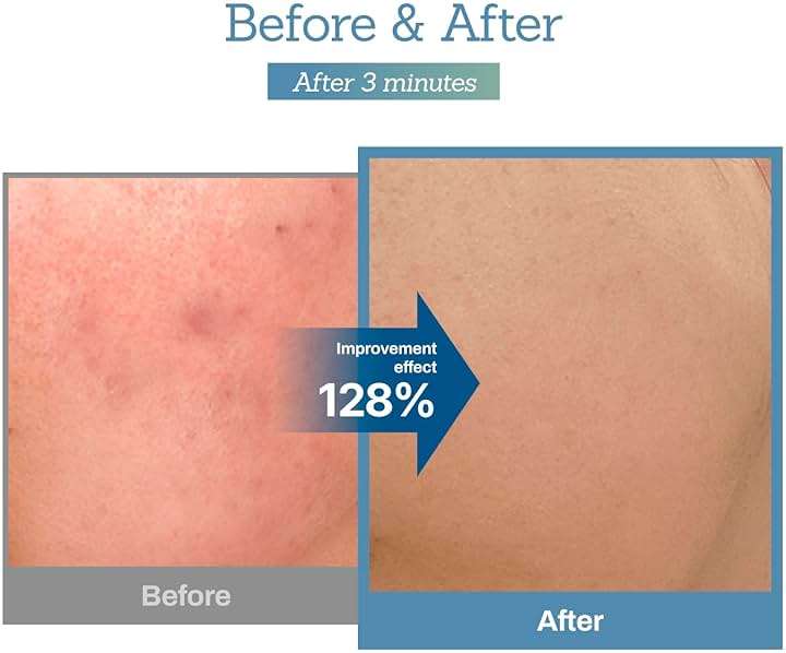 MEDITHERAPY Blue Centella Calming Cream - Hydrating Korean Face Moisturizer - Rapid Soothing Moisturizer Face Cream for All Types - Strengthening Skin Barrier for Glowing Skin - Non-Clogging 3.38 fl. - Image 5