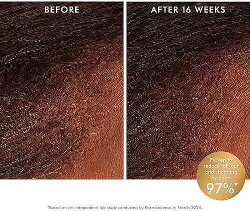Moroccanoil Revitalizing Scalp Tonic Treatment for Thinning Hair - Image 2
