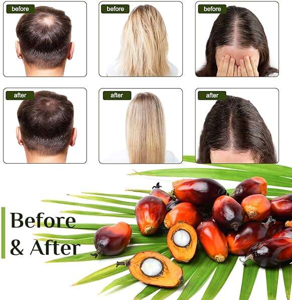 FEIBTH Raw Batana Oil for Hair Growth, Batana Oil Organic for Hair Growth, Batana Oil for Hair Growth Dr Sebi Organic, Prevent Hair Loss and Enhances Hair Thickness, 100g., White - Image 5