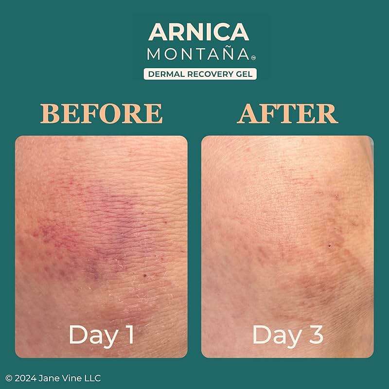 JANE VINE Arnica Gel For Face, Arnica Cream and Bruise Cream to Soothe with Aloe and Calendula for Face and Body, Menthol Free, Alcohol Free, 7oz Pump - Image 2