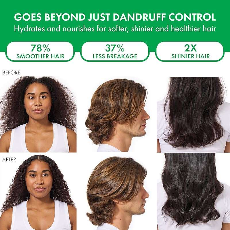 Vichy Dercos Dandruff Shampoo, Antifungal Itchy Scalp Treatment for Men & Women, Clinical Strength Selenium Sulfide, Formulated with Niacinamide & Salicylic Acid, Color Safe, Dermatologist Recommended - Image 6