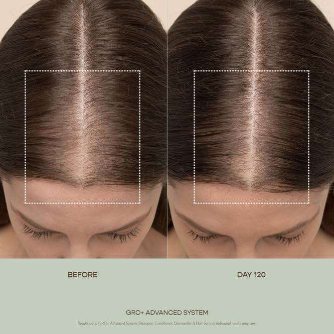 VEGAMOUR GRO+ Advanced Balancing Conditioner | Hydrates the Scalp, Nourishes and Softens Hair | For Severe Signs of Thinning | Color Safe, Vegan, Cruelty-Free, Formulated Without Silicones (8 Fl Oz) - Image 6